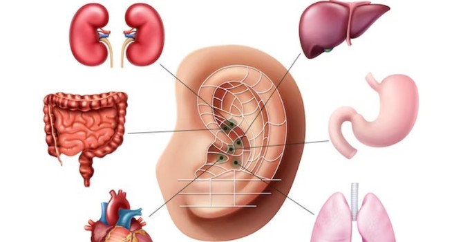 What is Auricular Acupuncture? image