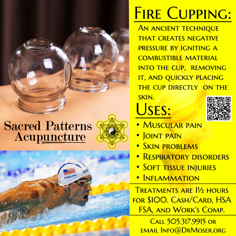 Fire Cupping - Health Benefits - Sacred Patterns Acupuncture - Dr. Andrew Moser, DOM, MBA - Albuquerque, NM